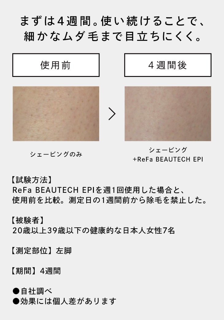 光美容器]リファビューテック エピ - ReFa BEAUTECH EPI | 商品情報