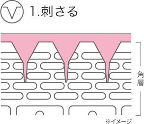 1.刺さる