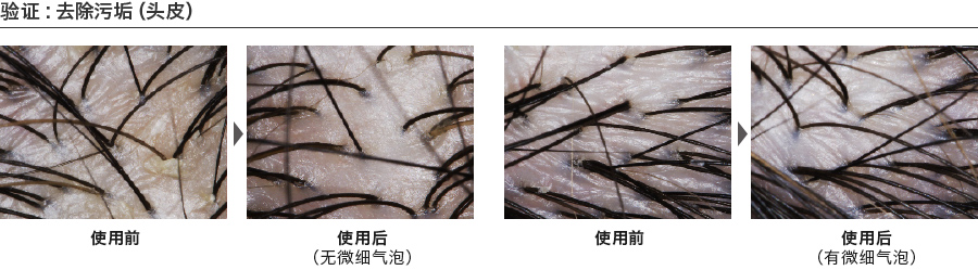 验证：去除污垢（头皮）